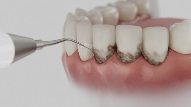 Trusted Teeth Cleaning And Checkup service in Falling Waters, WV - Dentist Open Now